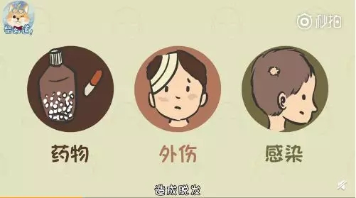 成年人为什么脱发